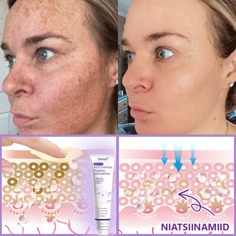 🇪🇪 Dermatoloogide lemmik🥦 | 🌥️Vitalisys® PDRN multi-peptiid kehamassaažikreem – Vananemisvastane, niisutav, pinguldav, taastav, siluv, akne ja plekkide eemaldamiseks, soolatüügaste ja sünnimärkide eemaldamiseks, psoriaasi leevendamiseks.❤️