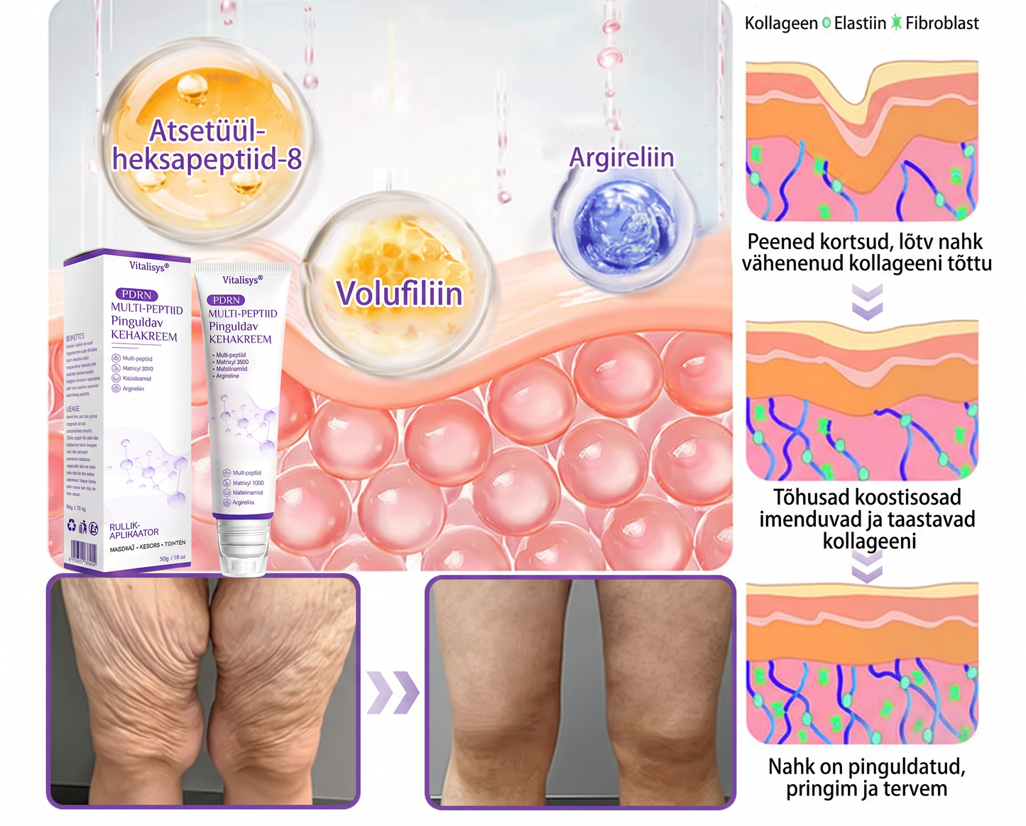 🇪🇪 Dermatoloogide lemmik🥦 | 🌥️Vitalisys® PDRN multi-peptiid kehamassaažikreem – Vananemisvastane, niisutav, pinguldav, taastav, siluv, akne ja plekkide eemaldamiseks, soolatüügaste ja sünnimärkide eemaldamiseks, psoriaasi leevendamiseks.❤️
