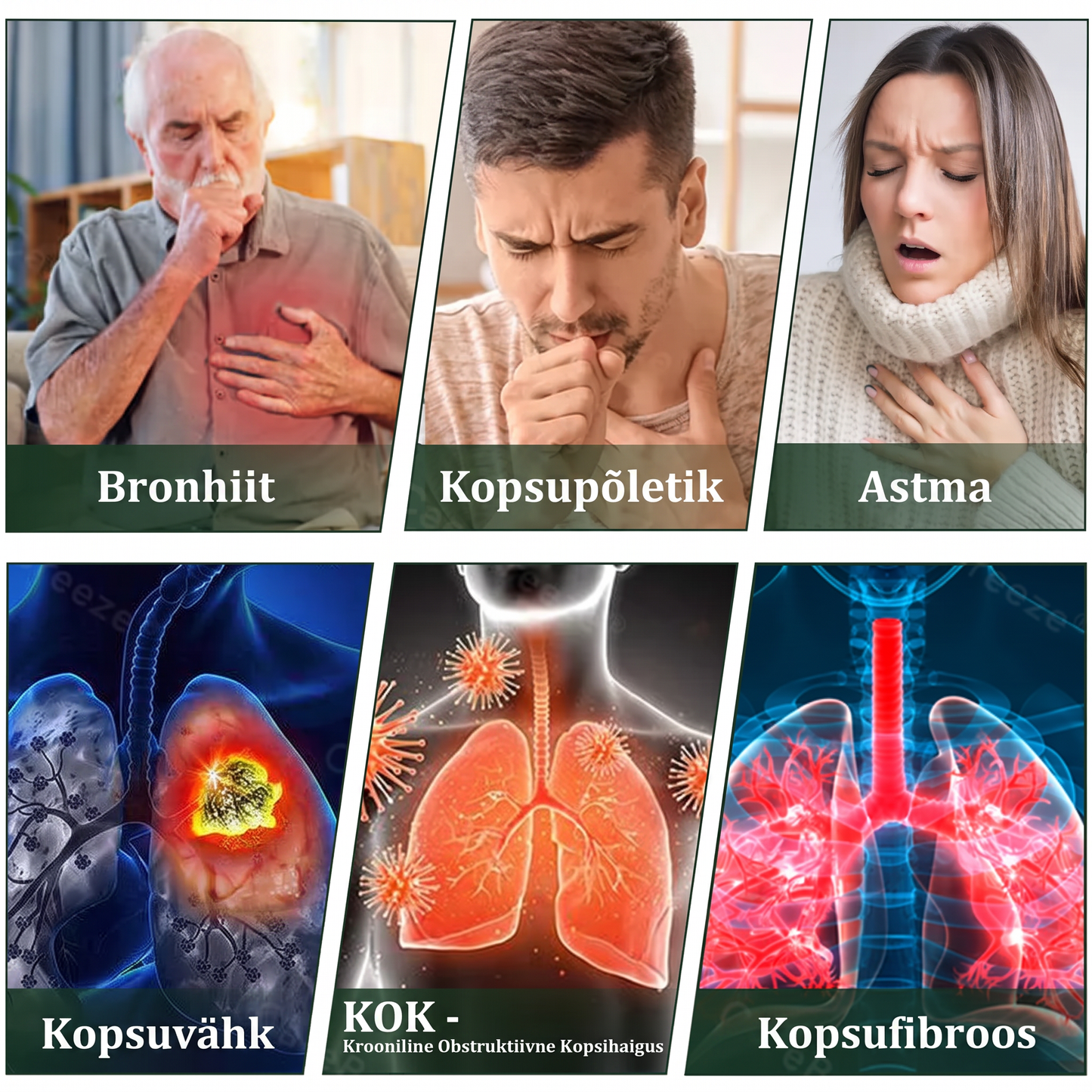 Tipptasemel eesti toode koduse kohaletoimetamisega 🥇 Murwon® taimne aurinhalaator kopsude puhastamiseks 🍍 Tõhus abi köha, kurgupõletiku, hingamisraskuste, lima, nohu, bronhiidi ja allergiate korral ❤️