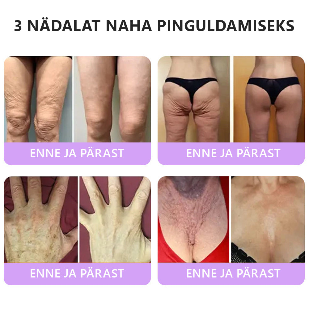 🇪🇪 Dermatoloogide lemmik🥦 | 🌥️Vitalisys® PDRN multi-peptiid kehamassaažikreem – Vananemisvastane, niisutav, pinguldav, taastav, siluv, akne ja plekkide eemaldamiseks, soolatüügaste ja sünnimärkide eemaldamiseks, psoriaasi leevendamiseks.❤️