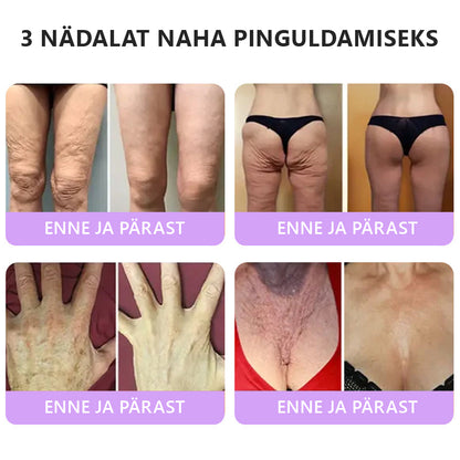 🇪🇪 Dermatoloogide lemmik🥦 | 🌥️Vitalisys® PDRN multi-peptiid kehamassaažikreem – Vananemisvastane, niisutav, pinguldav, taastav, siluv, akne ja plekkide eemaldamiseks, soolatüügaste ja sünnimärkide eemaldamiseks, psoriaasi leevendamiseks.❤️