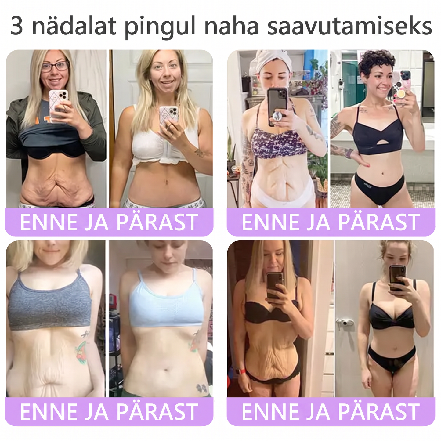 🇪🇪 Dermatoloogide lemmik🥦 | 🌥️Vitalisys® PDRN multi-peptiid kehamassaažikreem – Vananemisvastane, niisutav, pinguldav, taastav, siluv, akne ja plekkide eemaldamiseks, soolatüügaste ja sünnimärkide eemaldamiseks, psoriaasi leevendamiseks.❤️