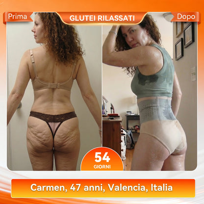 30%🎁🎁 𝐁𝑳𝑼𝐄𝐒𝐇𝓞𝑻® 𝟐𝟎𝟐𝟔 𝙈𝙤𝙧𝙞𝙣𝙜𝙖 & 𝘽𝙚𝙧𝙗𝙚𝙧𝙞𝙣𝙚 4-𝙄𝙣-1 𝙈𝙞𝙘𝙧𝙤-𝙋𝙖𝙧𝙩𝙞𝙘𝙡𝙚 𝙎𝙘𝙪𝙡𝙥𝙩𝙞𝙣𝙜 & 𝙁𝙖𝙩-𝘽𝙪𝙧𝙣 𝙎𝙝𝙤𝙧𝙩𝙨