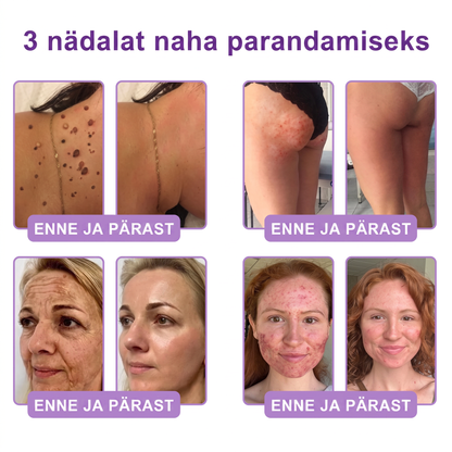 🇪🇪 Dermatoloogide lemmik🥦 | 🌥️Vitalisys® PDRN multi-peptiid kehamassaažikreem – Vananemisvastane, niisutav, pinguldav, taastav, siluv, akne ja plekkide eemaldamiseks, soolatüügaste ja sünnimärkide eemaldamiseks, psoriaasi leevendamiseks.❤️