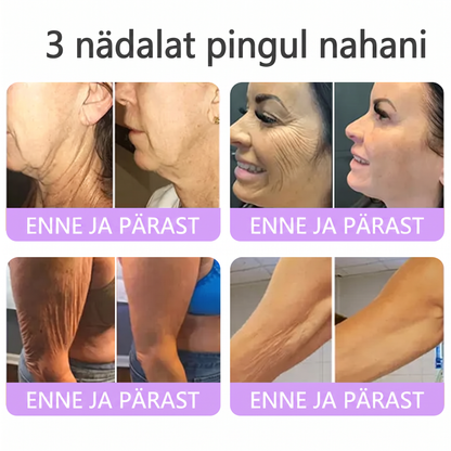 🇪🇪 Dermatoloogide lemmik🥦 | 🌥️Vitalisys® PDRN multi-peptiid kehamassaažikreem – Vananemisvastane, niisutav, pinguldav, taastav, siluv, akne ja plekkide eemaldamiseks, soolatüügaste ja sünnimärkide eemaldamiseks, psoriaasi leevendamiseks.❤️