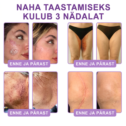 🇪🇪 Dermatoloogide lemmik🥦 | 🌥️Vitalisys® PDRN multi-peptiid kehamassaažikreem – Vananemisvastane, niisutav, pinguldav, taastav, siluv, akne ja plekkide eemaldamiseks, soolatüügaste ja sünnimärkide eemaldamiseks, psoriaasi leevendamiseks.❤️