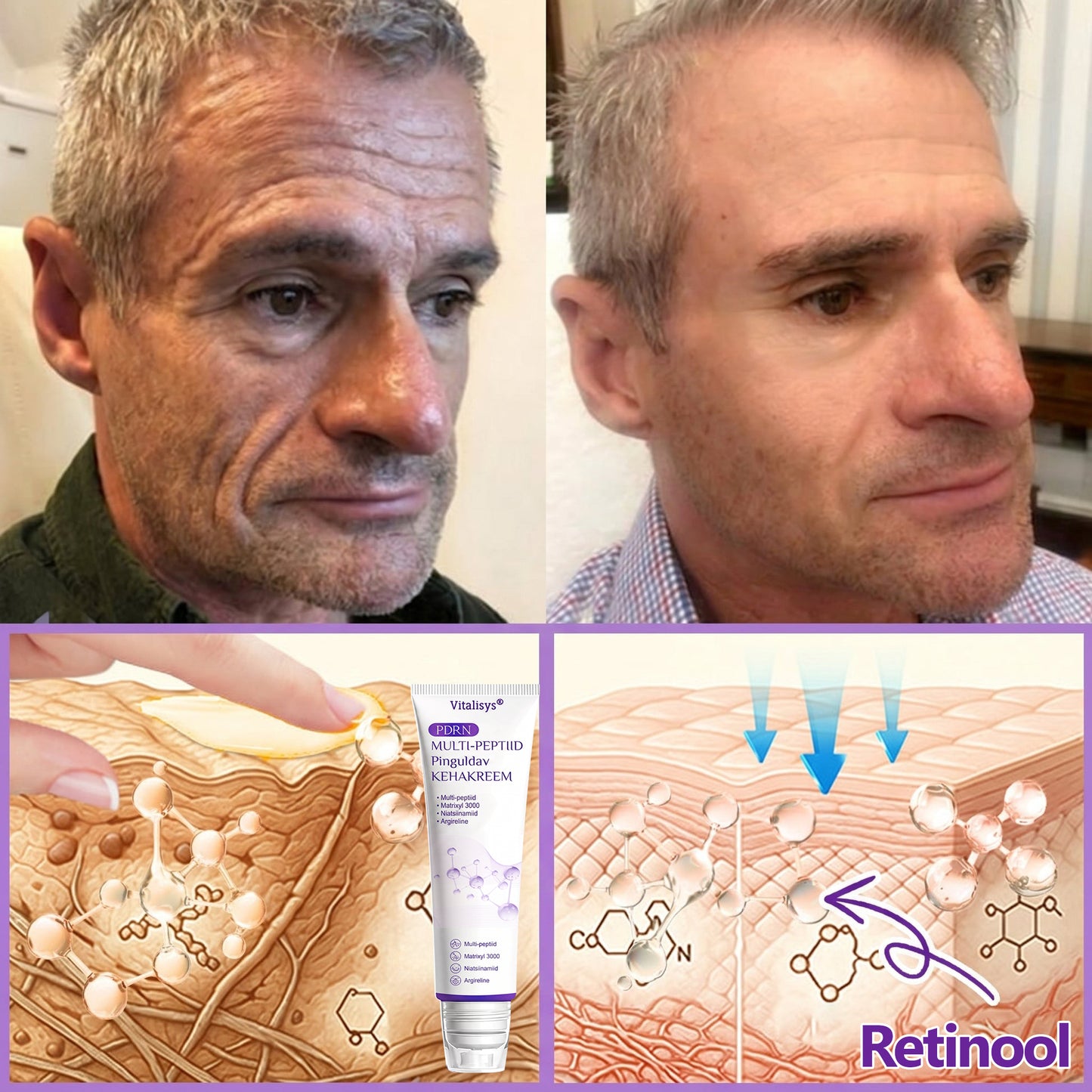 🇪🇪 Dermatoloogide lemmik🥦 | 🌥️Vitalisys® PDRN multi-peptiid kehamassaažikreem – Vananemisvastane, niisutav, pinguldav, taastav, siluv, akne ja plekkide eemaldamiseks, soolatüügaste ja sünnimärkide eemaldamiseks, psoriaasi leevendamiseks.❤️